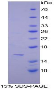 CASP7 / Caspase 7 Protein - Recombinant Caspase 7 By SDS-PAGE