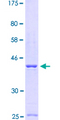 CASQ1 / Calsequestrin 1 Protein - 12.5% SDS-PAGE Stained with Coomassie Blue.