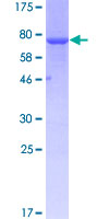 CASQ2 / Calsequestrin 2 Protein - 12.5% SDS-PAGE of human CASQ2 stained with Coomassie Blue