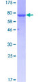 CASQ2 / Calsequestrin 2 Protein - 12.5% SDS-PAGE of human CASQ2 stained with Coomassie Blue