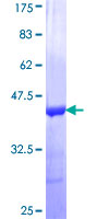 CASQ2 / Calsequestrin 2 Protein - 12.5% SDS-PAGE Stained with Coomassie Blue