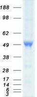 CASQ2 / Calsequestrin 2 Protein - Purified recombinant protein CASQ2 was analyzed by SDS-PAGE gel and Coomassie Blue Staining