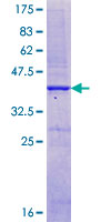 CASR/Calcium Sensing Receptor Protein - 12.5% SDS-PAGE Stained with Coomassie Blue.