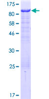 CASS4 Protein - 12.5% SDS-PAGE of human C20orf32 stained with Coomassie Blue