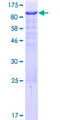 CASS4 Protein - 12.5% SDS-PAGE of human C20orf32 stained with Coomassie Blue