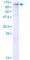 CAST / Calpastatin Protein - 12.5% SDS-PAGE of human CAST stained with Coomassie Blue