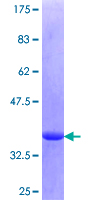 CAST / Calpastatin Protein - 12.5% SDS-PAGE Stained with Coomassie Blue.