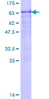 CAT / Catalase Protein - 12.5% SDS-PAGE of human CAT stained with Coomassie Blue