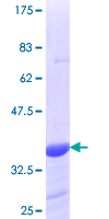 CAT / Catalase Protein - 12.5% SDS-PAGE Stained with Coomassie Blue.