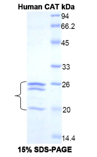 CAT / Catalase Protein - Recombinant Catalase By SDS-PAGE
