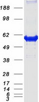CAT / Catalase Protein - Purified recombinant protein CAT was analyzed by SDS-PAGE gel and Coomassie Blue Staining