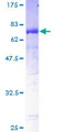 CATIP / C2orf62 Protein - 12.5% SDS-PAGE of human MGC50811 stained with Coomassie Blue