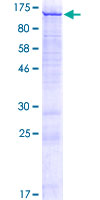 CATSPER1 / CATSPER Protein - 12.5% SDS-PAGE of human CATSPER1 stained with Coomassie Blue