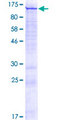 CATSPER1 / CATSPER Protein - 12.5% SDS-PAGE of human CATSPER1 stained with Coomassie Blue