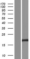 CAV1 / Caveolin 1 Protein - Western validation with an anti-DDK antibody * L: Control HEK293 lysate R: Over-expression lysate
