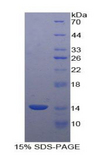 CAV1 / Caveolin 1 Protein - Recombinant Caveolin 1 By SDS-PAGE