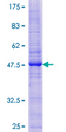 CAV2 / Caveolin 2 Protein - 12.5% SDS-PAGE of human CAV2 stained with Coomassie Blue