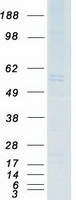 CAV2 / Caveolin 2 Protein - Purified recombinant protein CAV2 was analyzed by SDS-PAGE gel and Coomassie Blue Staining