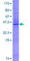 CAV3 / Caveolin 3 Protein - 12.5% SDS-PAGE of human CAV3 stained with Coomassie Blue