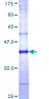 CAV3 / Caveolin 3 Protein - 12.5% SDS-PAGE Stained with Coomassie Blue.