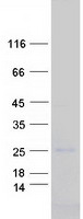 CAV3 / Caveolin 3 Protein - Purified recombinant protein CAV3 was analyzed by SDS-PAGE gel and Coomassie Blue Staining