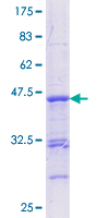 CBFA1 / RUNX2 Protein - 12.5% SDS-PAGE Stained with Coomassie Blue.