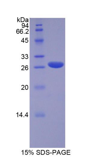 CBFA1 / RUNX2 Protein - Recombinant Runt Related Transcription Factor 2 By SDS-PAGE