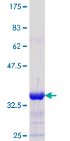 CBFA2T2 / MTGR1 Protein - 12.5% SDS-PAGE Stained with Coomassie Blue.