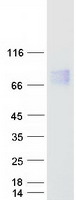 CBFA2T2 / MTGR1 Protein - Purified recombinant protein CBFA2T2 was analyzed by SDS-PAGE gel and Coomassie Blue Staining