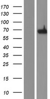 CBFA2T3 Protein - Western validation with an anti-DDK antibody * L: Control HEK293 lysate R: Over-expression lysate