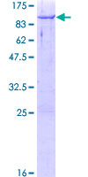 CBFA2T3 Protein - 12.5% SDS-PAGE of human CBFA2T3 stained with Coomassie Blue