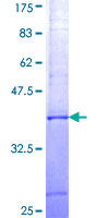 CBFA2T3 Protein - 12.5% SDS-PAGE Stained with Coomassie Blue.
