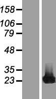 CBFB Protein - Western validation with an anti-DDK antibody * L: Control HEK293 lysate R: Over-expression lysate