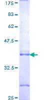 CBFB Protein - 12.5% SDS-PAGE Stained with Coomassie Blue.
