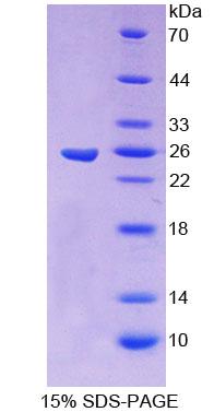 CBFB Protein - Recombinant  Core Binding Factor Beta Subunit By SDS-PAGE