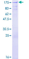 CBLB Protein - 12.5% SDS-PAGE of human CBLB stained with Coomassie Blue