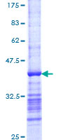 CBLB Protein - 12.5% SDS-PAGE Stained with Coomassie Blue.