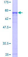 CBLC Protein - 12.5% SDS-PAGE of human CBLC stained with Coomassie Blue