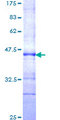 CBLL1 / HAKAI Protein - 12.5% SDS-PAGE Stained with Coomassie Blue.