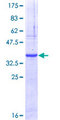CBLN2 / Cerebellin 2 Protein - 12.5% SDS-PAGE Stained with Coomassie Blue.
