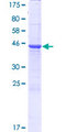 CBLN4 / Cerebellin 4 Protein - 12.5% SDS-PAGE of human CBLN4 stained with Coomassie Blue