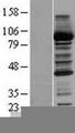 CBR / CBR1 Protein - Western validation with an anti-DDK antibody * L: Control HEK293 lysate R: Over-expression lysate