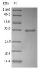 CBR / CBR1 Protein - (Tris-Glycine gel) Discontinuous SDS-PAGE (reduced) with 5% enrichment gel and 15% separation gel.