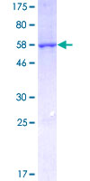 CBR / CBR1 Protein - 12.5% SDS-PAGE of human CBR1 stained with Coomassie Blue