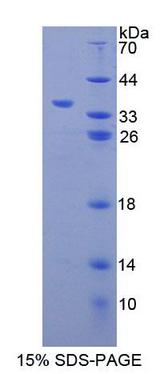 CBR / CBR1 Protein - Recombinant Carbonyl Reductase 1 By SDS-PAGE