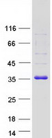 CBR / CBR1 Protein - Purified recombinant protein CBR1 was analyzed by SDS-PAGE gel and Coomassie Blue Staining