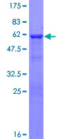 CBR3 Protein - 12.5% SDS-PAGE of human CBR3 stained with Coomassie Blue