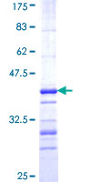CBR3 Protein - 12.5% SDS-PAGE Stained with Coomassie Blue.