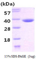 CBR3 Protein