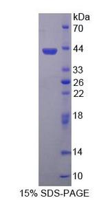 CBR3 Protein - Recombinant  Carbonyl Reductase 3 By SDS-PAGE